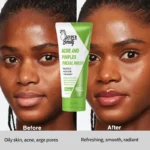 Hyper Beauty Acne and Pimples Facial Wash - Image 6